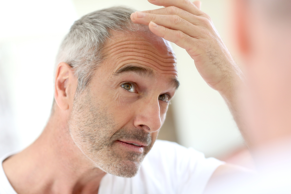 Senior man and hair loss issue-1