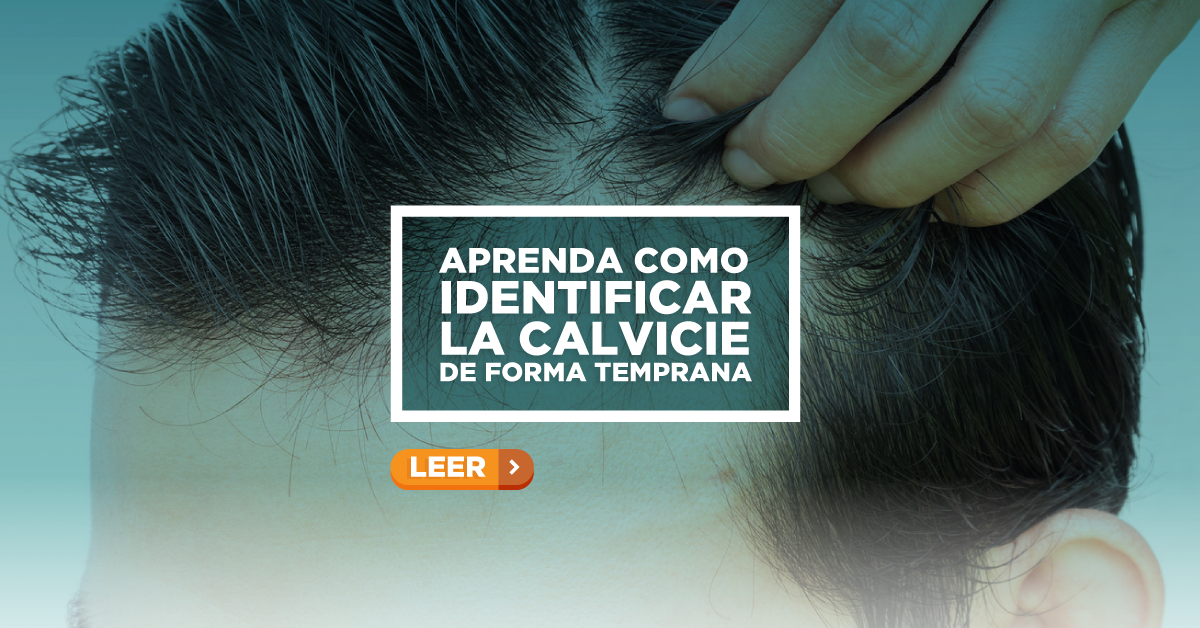 Primeros síntomas de la calvicie
